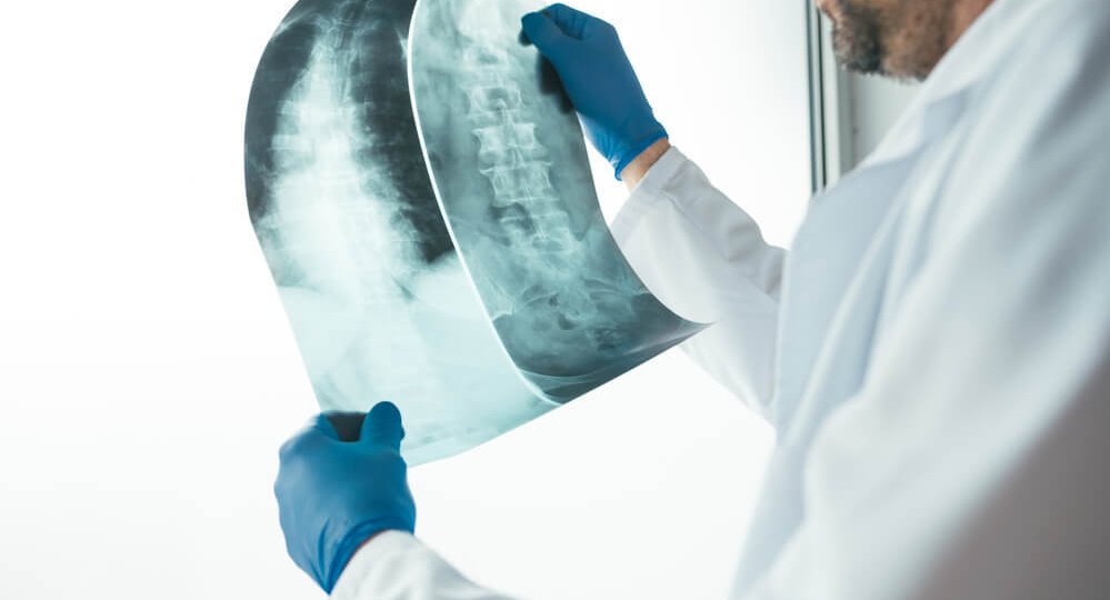 doctor-examining-x-ray-of-the-human-spine-2021-08-26-23-02-52-utc (1) (1)