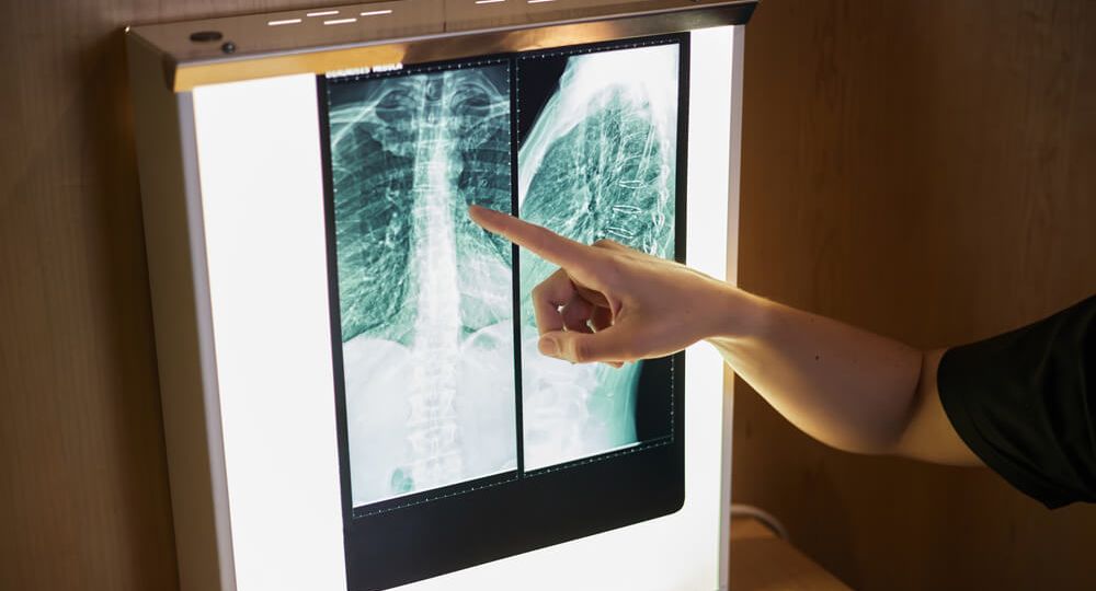 doctor-analysing-the-result-of-a-spinal-x-ray-2022-08-25-19-52-14-utc-1-1