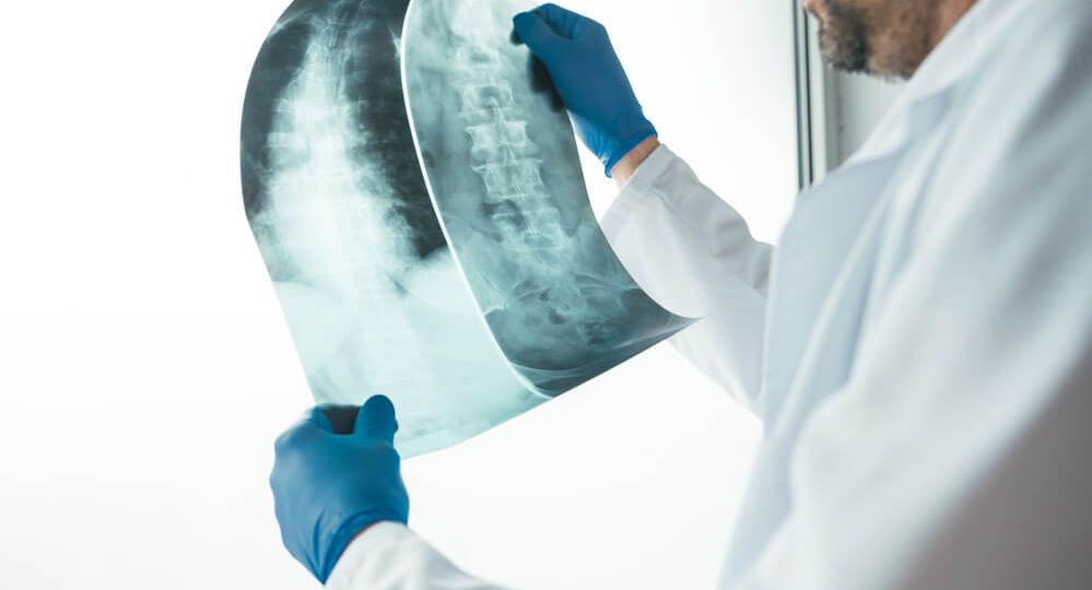 doctor-examining-x-ray-of-the-human-spine-2021-08-26-23-02-52-utc-1-1