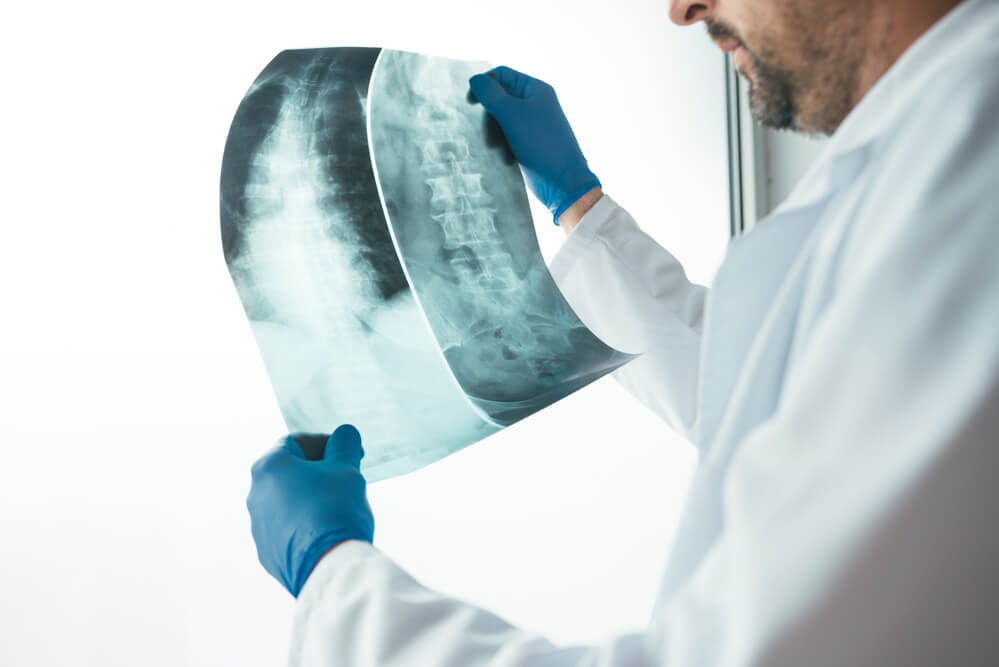 doctor-examining-x-ray-of-the-human-spine-2021-08-26-23-02-52-utc-1-1